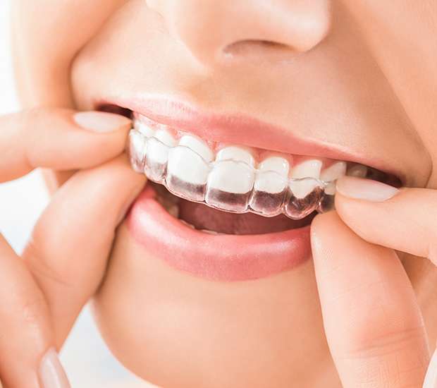 Pembroke Pines Does Invisalign Really Work