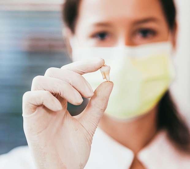 Pembroke Pines Tooth Extraction